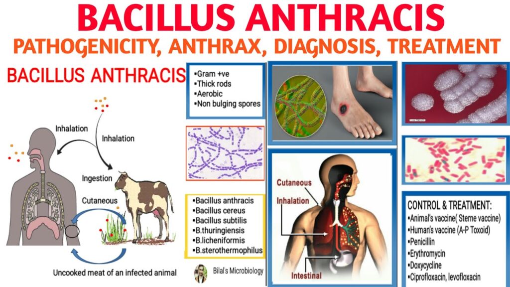 Kisah Konspirasi Virus Antraks